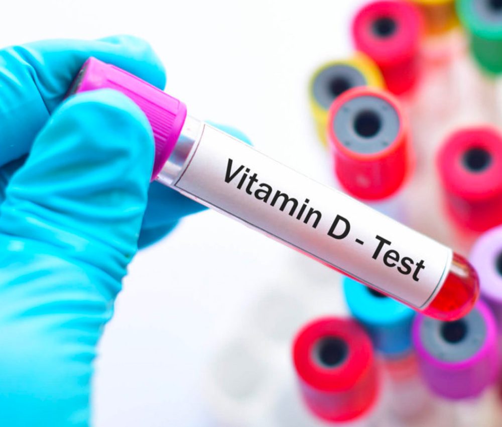 Test-vitamina-D-1024x683